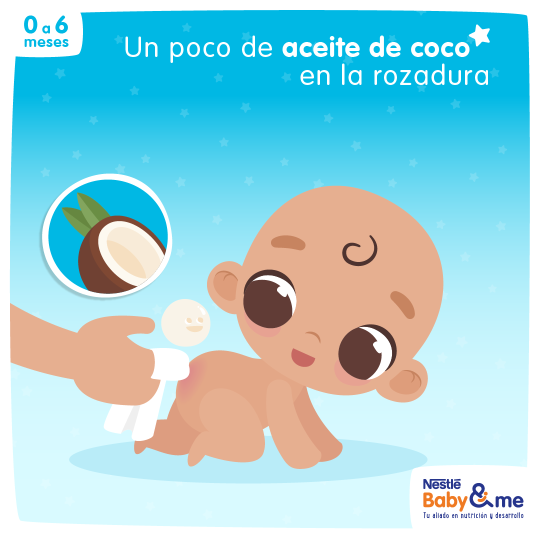 Un poco de aceite de coco en la rozadura del bebé le servirá a setirse mejor